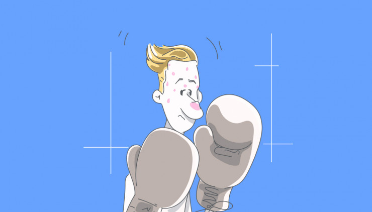 Les boutons