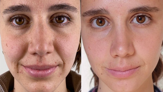Aline, 26
